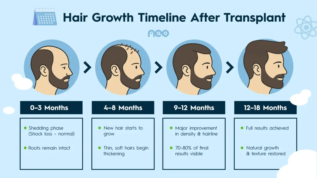 hair transplant in turkey
